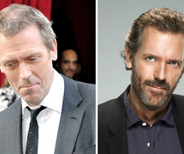 Hugh Laurie Saç Ektirdi